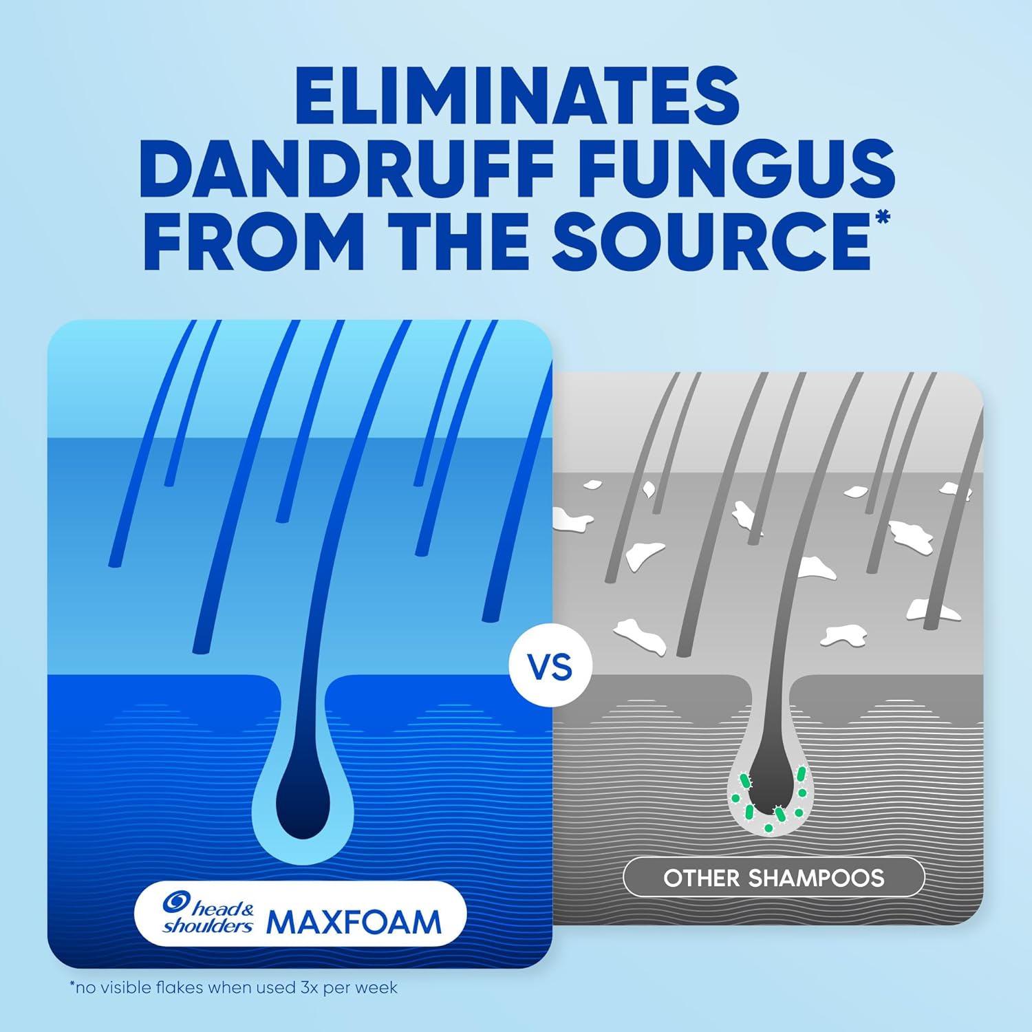 Head & Shoulder Shampoo Menthol Refresh 1L