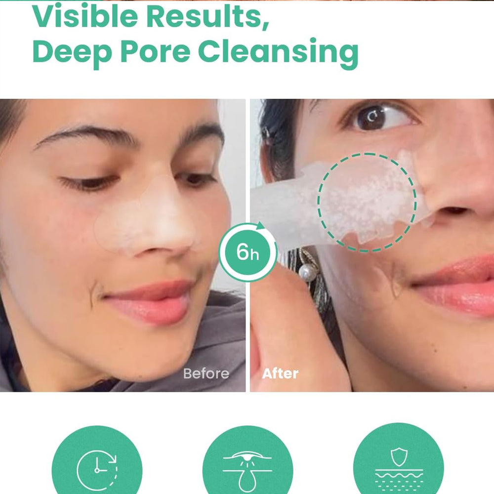 GLAM UP SPOTLESS NOSE PATCH