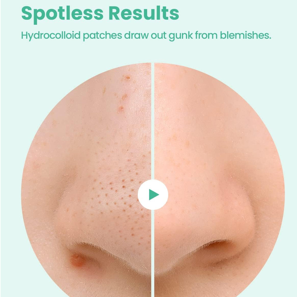 GLAM UP SPOTLESS NOSE PATCH